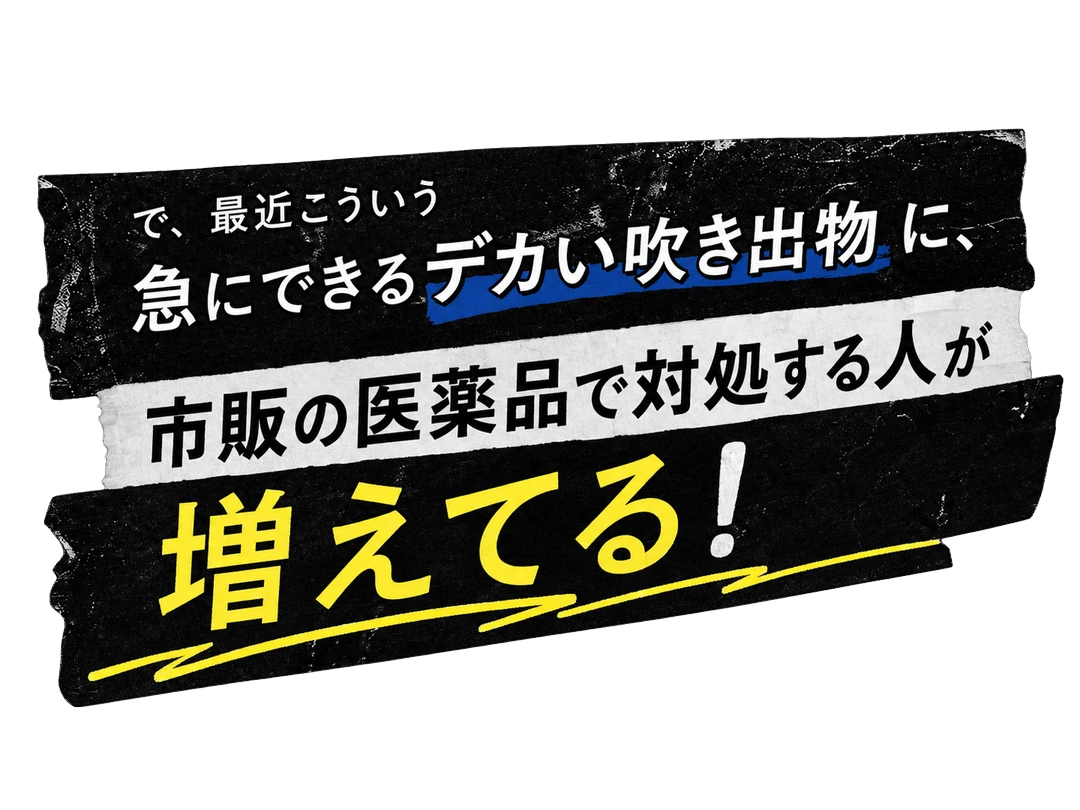 で、最近こういう急にできるデカい吹き出物に、市販の医薬品で対処する人が増えてる！